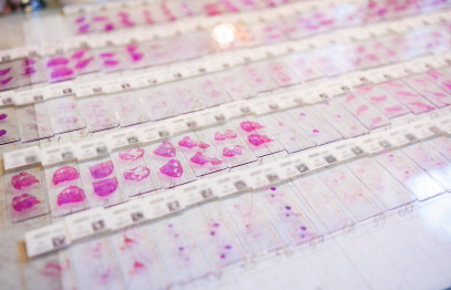 Stradiņa slimnīca iesaistās inovatīvā projektā ātrākai onkoloģisko slimību atklāšanai